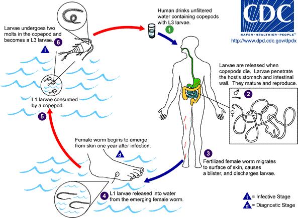 Đường lây nhiễm giun D.medinensis